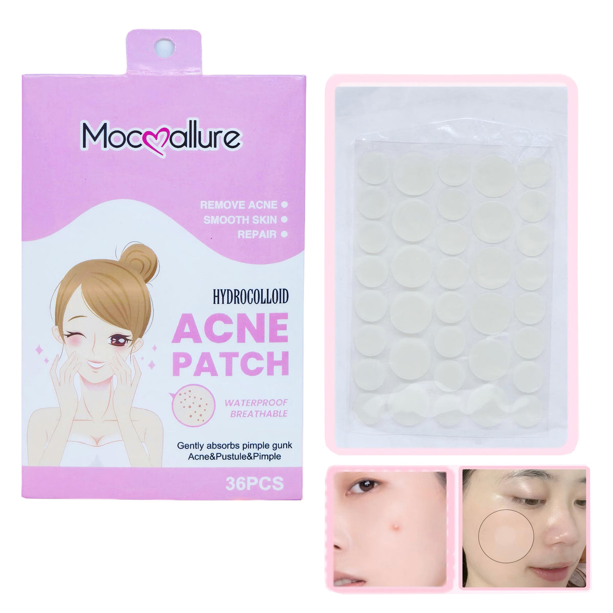 Parches Transparentes para Acné – 36 Unidades Invisibles y Efectivas(Mayoreo)