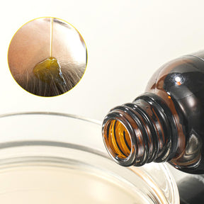 Aceite para Crecimiento del Cabello con Extractos Herbales Naturales（Mayoreo）